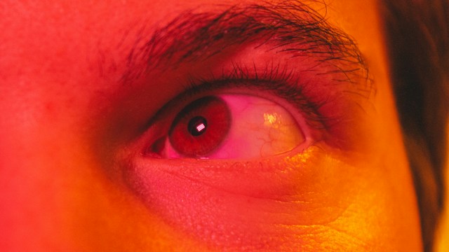 Extreme macro close-up shot of an irritated red human eye under warm lighting.